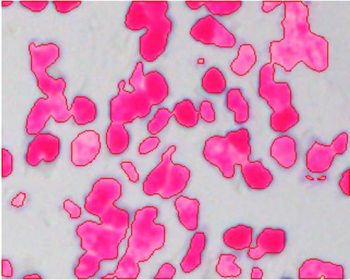 細(xì)胞圖像分割
